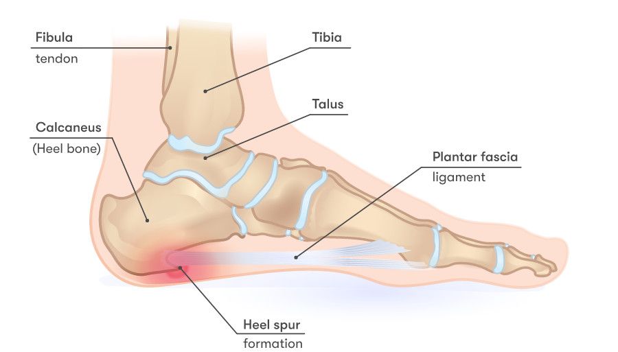 Lær mere om hæl spore
