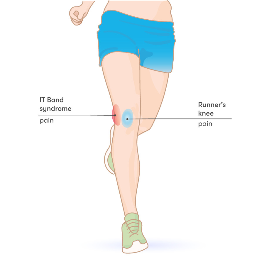 Løberknæ: er det, og hvordan behandles? - BeneFiT